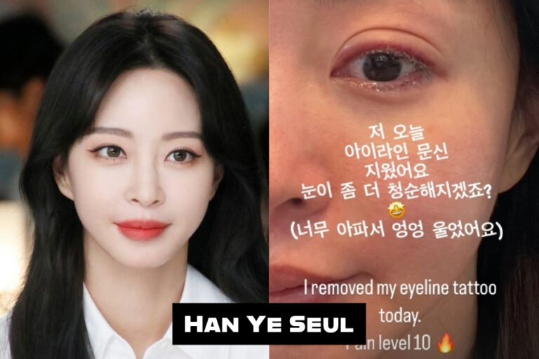 Actress Han Ye Seul Underwent Eyeline Tattoo Removal